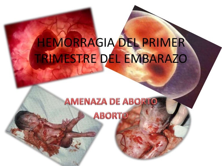 Es normal sangrado en el primer mes de embarazo